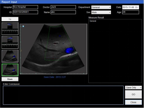 Color Doppler Ultrasound NEUCU36