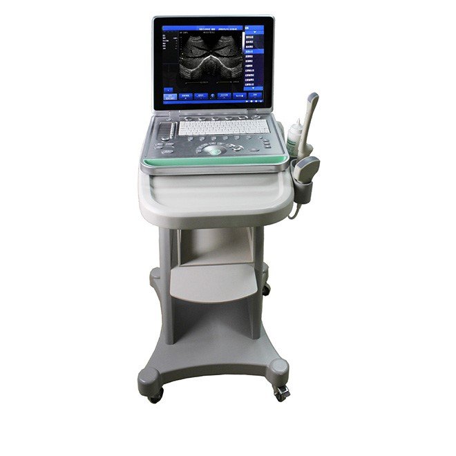 Ultrasound Scanner NEUPU25+