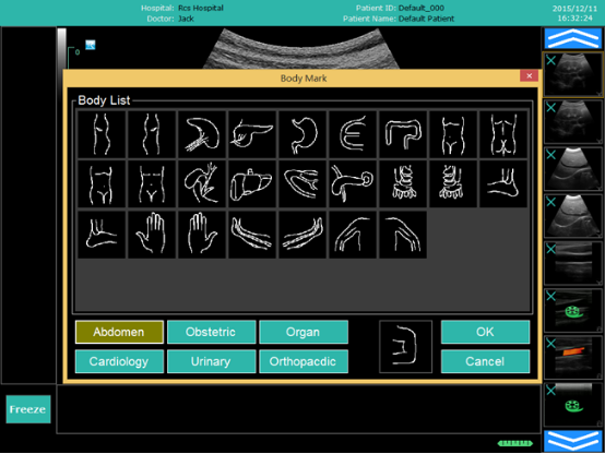 Color Doppler Ultrasound NEUCU36