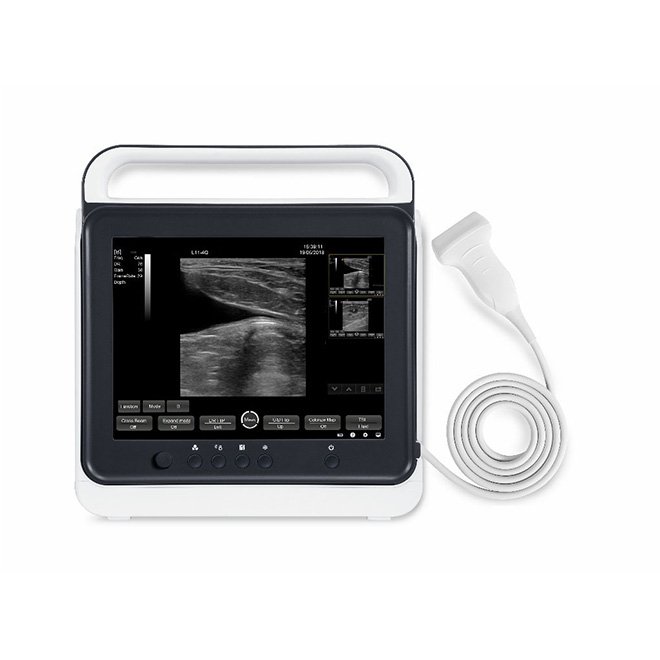 Portable Touch Screen Veterinary Ultrasound Scanner Machine NEUVU40