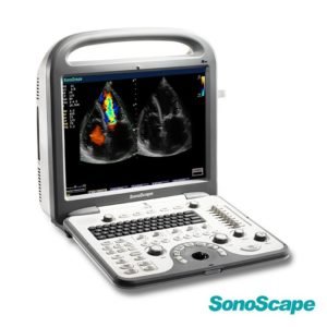 4D Cardiac Stress Color Doppler Ultrasound SonoScape S8