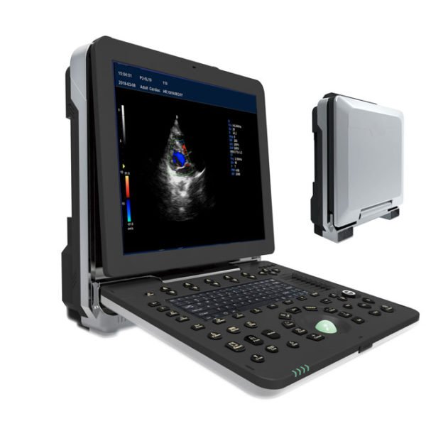 Professional Laptop 4D Color Ultrasound Scanner NEUCU64
