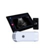 Wifi Portable Ultrasound Scanner Machine NEUVU49