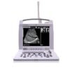 Portable Ultrasound Scanner NEUPU49