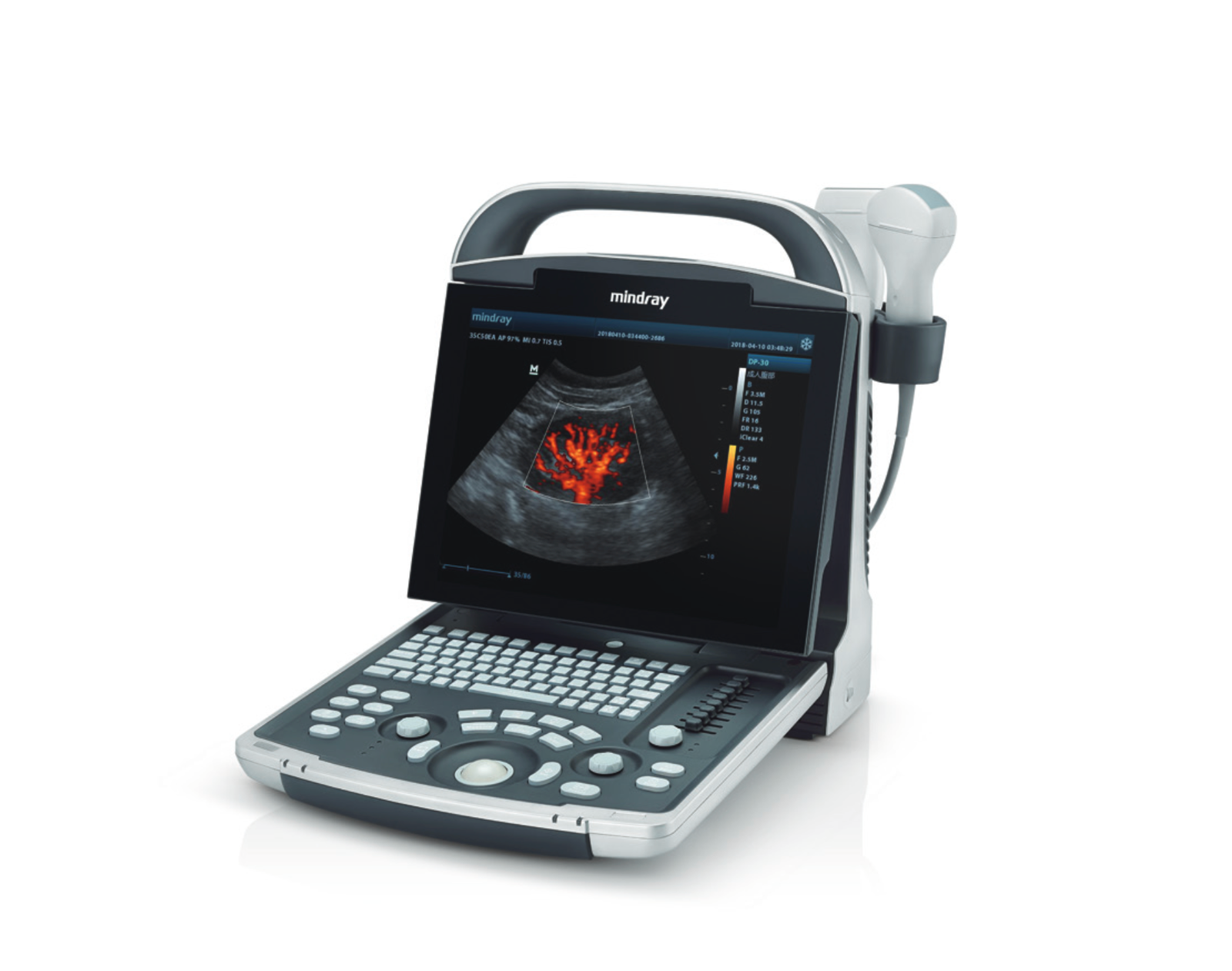 Digital Ultrasound Machine Mindray DP-30